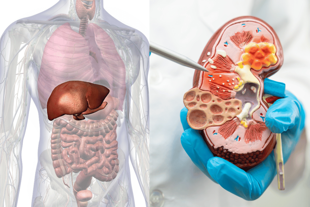 Organ Transplantation