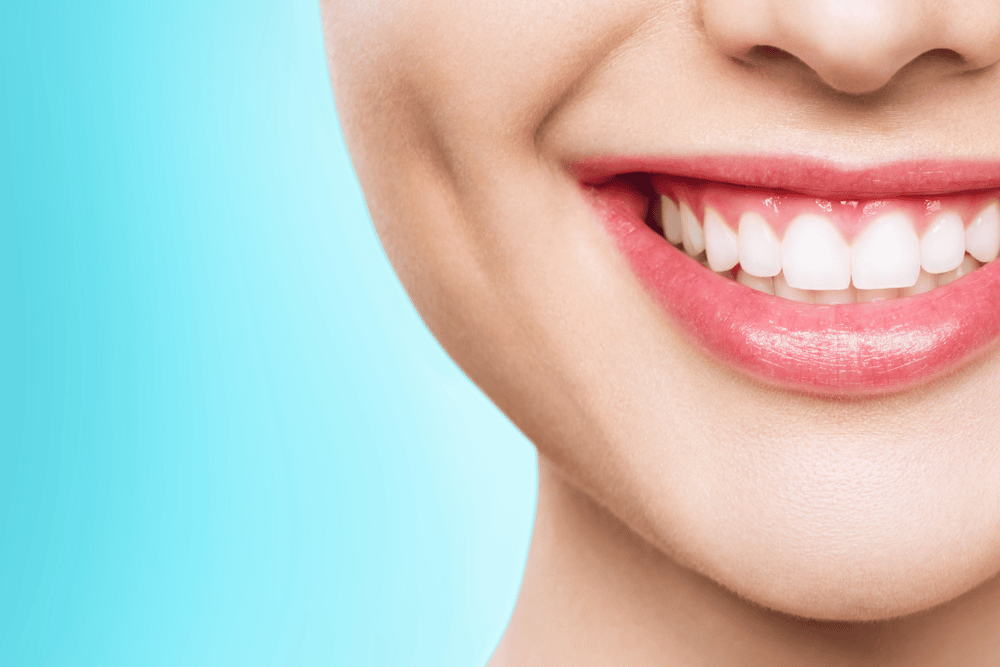 best teeth whitening technology