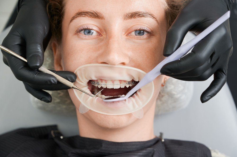 Dental Implantation & Cosmetic Dentistry for a Healthy Smile