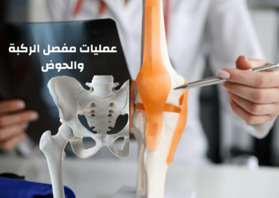 عمليات تبديل المفاصل